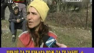 За хигиената и дупките