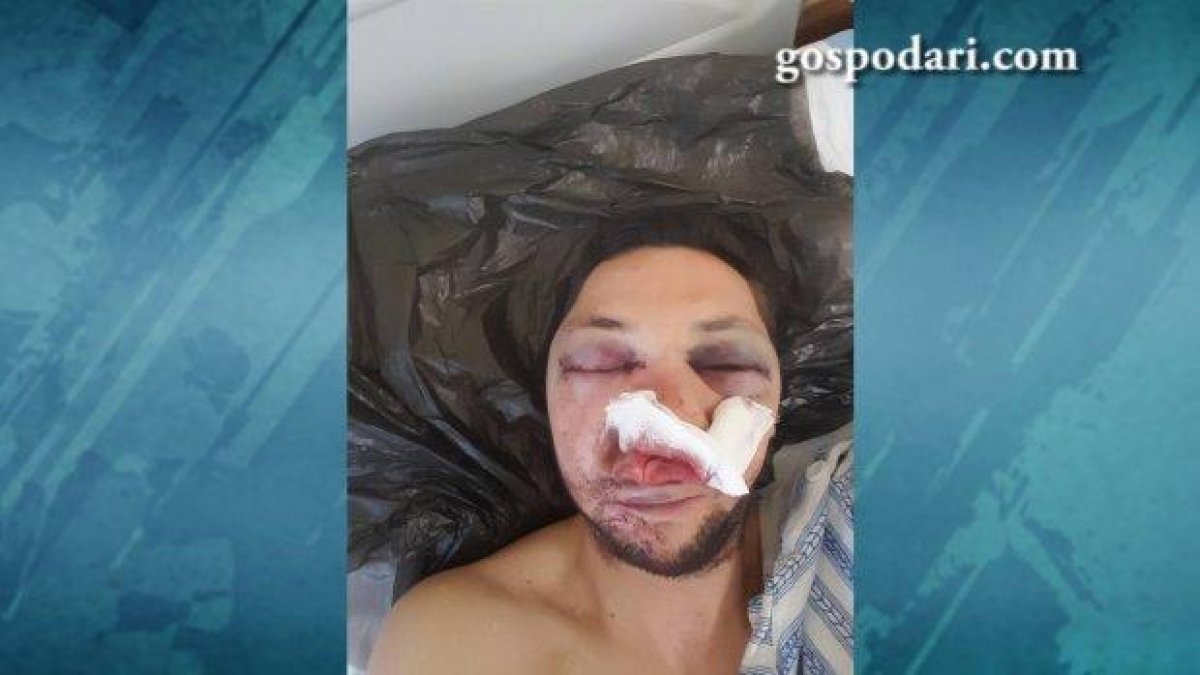 Пребиха журналист в Поморие, питали го докога ще пише