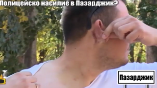 Полицията в Пазарджик разследва сигнала за пребития от служители на реда мъж (видео)