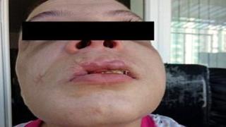 Изроди превърнали българка в секс робиня, била е брутално бита и кълцана от сутеньорите (видео)