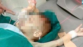 Близначета с тежки травми бяха приети в болница, подозира се домашно насилие (видео)