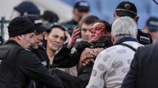 БФС скандално реши да накаже Левски само с 1 мач без публика след инцидента с ранената полицайка