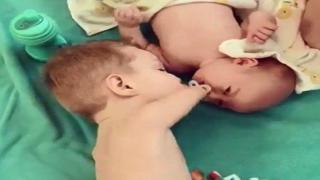 Детенце без ръце трогна света с грижовността, която показа към разплакано бебе (видео)