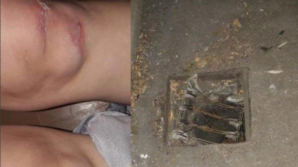 Жена падна в шахта без капак в София