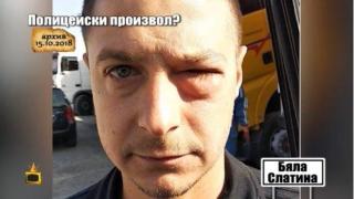 Какво показа проверката на сигнала за полицейски произвол?