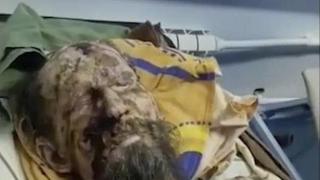 Пълен обрат по случая с мъжа "мумия", прекарал един месец в бърлога на мечка (видео и снимки)