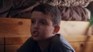 Момче има алергия към слънчевата светлина. Цял град преобръща за него нощта в ден (видео)