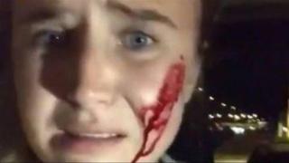 Раниха веганка, опитала се да спаси 16 зайци от ферма (видео и снимки)