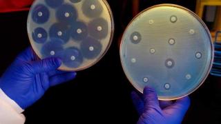 Изкуствен интелект откри нов мощен антибиотик