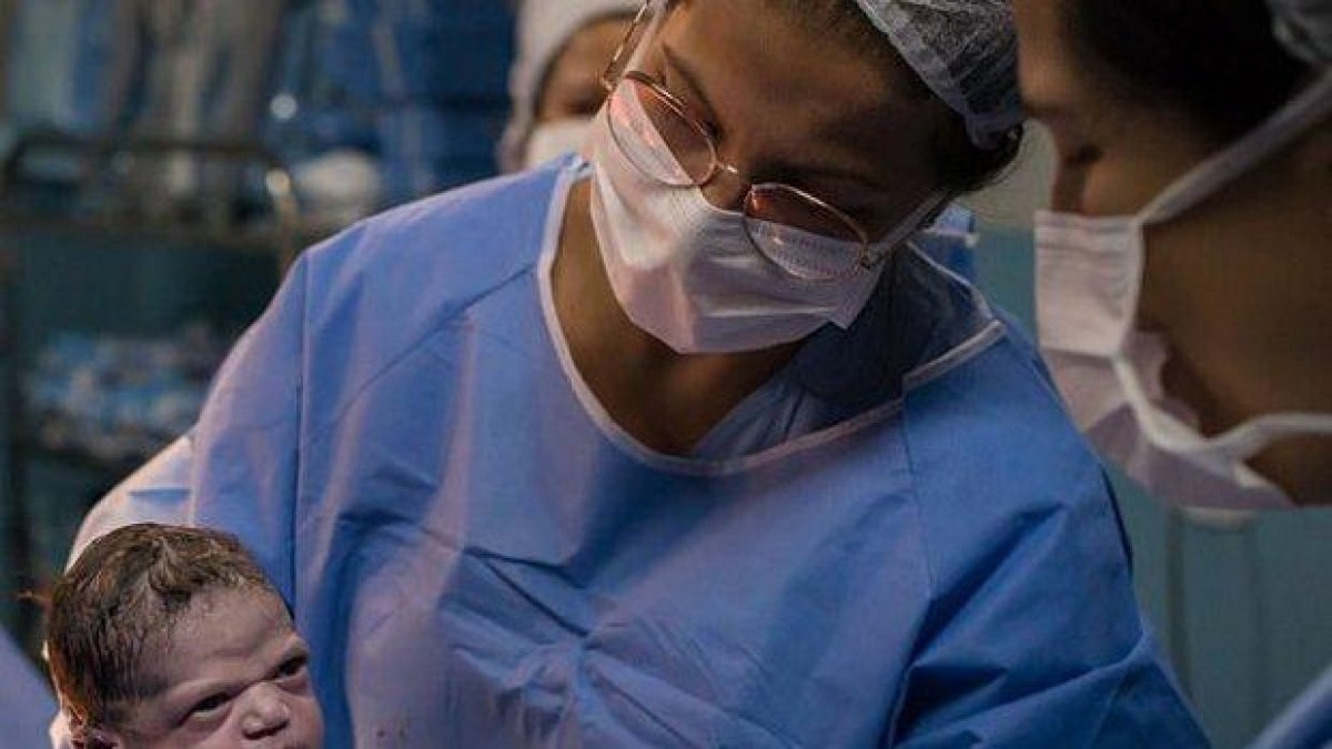 Току що родено бебе, което се мръщи на акущерката, стана хит в мрежата (снимки)