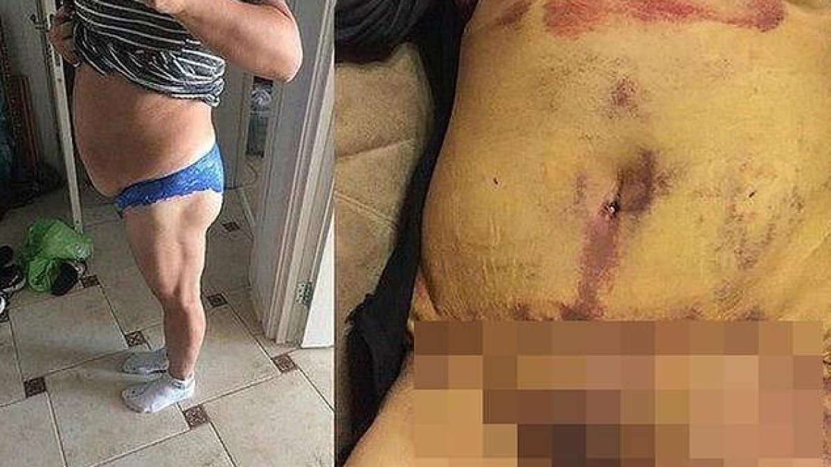 Арестуваха фалшив пластичен хирург, обезобразил десетки пациентки (снимки)