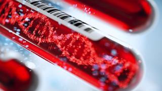 Учени създадоха нов вид кръвен тест, който може да открие повече от 50 вида рак