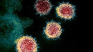 Мъж на 57 години стана деветата жертва на коронавируса у нас