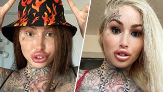 Instagram-модел вече нe може да пие през сламка след поредната си пластична операция на устните (видео и снимки)