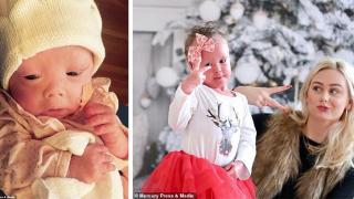 4-годишно момиченце с рядко заболяване на кожата получи договор от модна агенция (снимки)