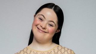 18-годишен модел със синдрома на Даун изгря на корицата на Vogue (снимки)
