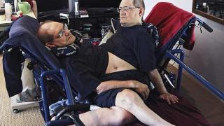 Най-дълго оцелелите сиамски близнаци в света починаха на 68 годишна възраст (снимки)