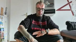Мъж премахна ушите си и направи други модификации по тялото си за 6000 паунда (снимки)
