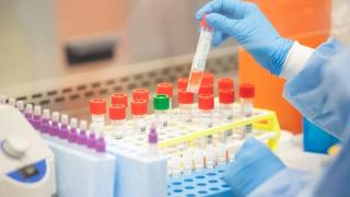 Спряха тестовете на ваксината срещу коронавирус на Оксфорд и AstraZeneca