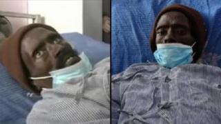 Мъж, сметнат за мъртъв, "се събудил" с писъци, като започнали да балсамират тялото му