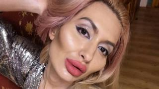 Жената с най-големите скули в света иска още пластични операции (снимки)