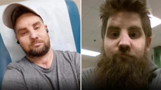 Мъж разкри пълната си промяна след лицева трансплантация заради тежък инцидент (видео)