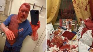 Нападнаха нобеловия лауреат Дмитрий Муратов