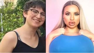 Родителите на млада жена не говорят с нея след серия операции, превърнали я в "човешко Барби" (видео и снимки)