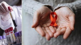 Четвърти пациент в света е излекуван от ХИВ