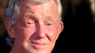 Заради нескопосана операция: мъж не може да затвори очи 3 години (видео)