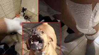 Мъж е с тежки ухапвания от съседски питбул (видео)
