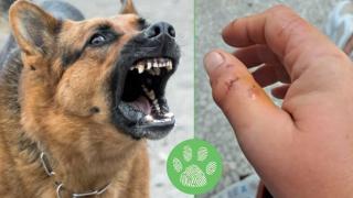 За пореден път куче без повод и намордник нападна жена и уби любимеца ѝ (видео)