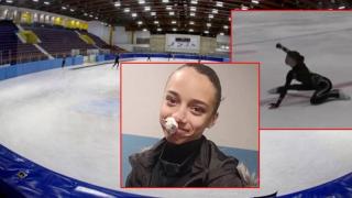 12-годишна фигуристка излезе на леда с кървящ нос заради абсурдните условия в Зимния дворец (видео)
