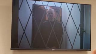 По тялото на Навални има синини, твърди медик