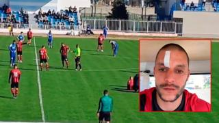 Прекратиха мач в Несебър заради побой над играч (видео)