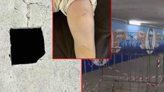 Дете получи хематом след падане в необезопасена шахта (видео)