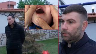 Дете пострада в дневен център в Пловдив - родители и ръководство с противоположни тези за случилото се (видео)