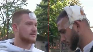 Замесиха кмета на ловешко село в масов бой с четирима ранени (видео)