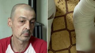 Зов за помощ: Мъж може да загуби краката си заради липса на адекватно лечение (видео)