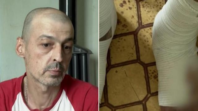 Зов за помощ: Мъж може да загуби краката си заради липса на адекватно лечение (видео)