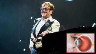 Елтън Джон е с частична загуба на зрението