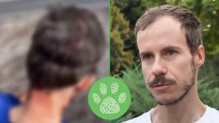 Поредното куче без намордник и повод нападна спортист, подготвящ се за състезание (видео)