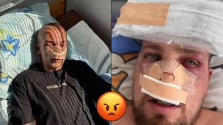 Двама братя са в болница след побой в троянска дискотека (видео)