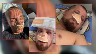 Мелето във варненска дискотека се е случило заради жена (видео)