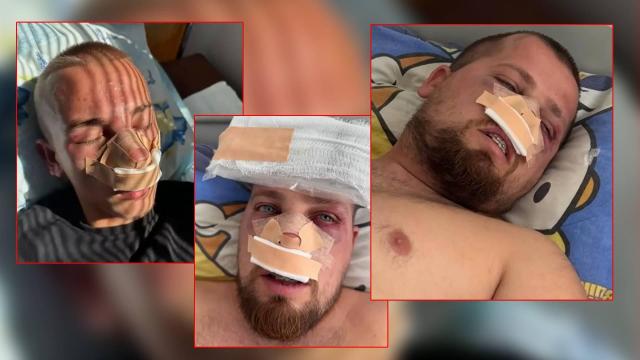 Мелето във варненска дискотека се е случило заради жена (видео)