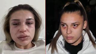 Мъж преби бившата си приятелка, нападна и баба ѝ в Кресна, пуснаха го от ареста с "подписка" (видео)