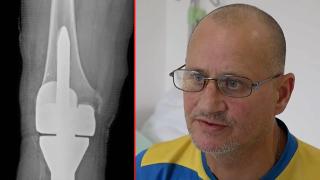 Изкуствен интелект помогна на лекари да спасят пациент в Пловдив (видео)