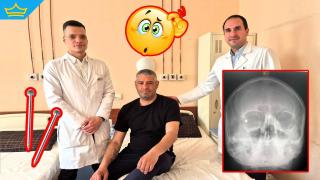 Спасиха зрението на мъж, след като пирон е пробил окото му (снимки)