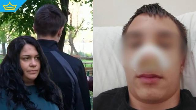 13-годишно момче от Русе е със счупен нос и комоцио след побой от негов връстник