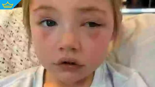 Австралийче остана без зрение на едното око, след като погълна често използван в домакинствата предмет